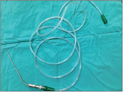 Gas (Oxygen) insufflation: A new technique for the visualization of the operative field during hypospadias surgery